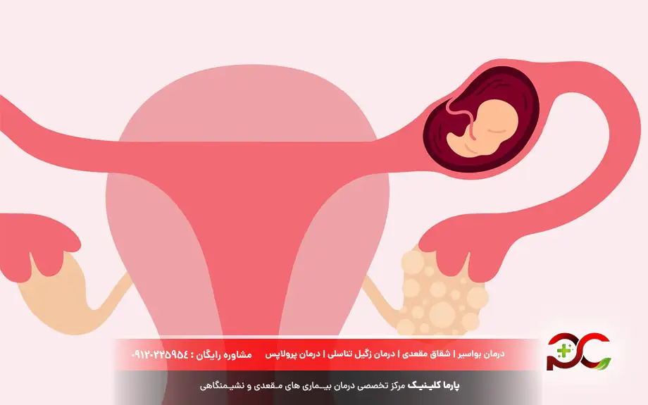 دل درد خطرناک